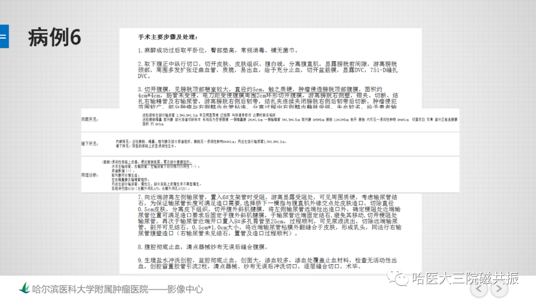 影像PPT - 【PPT】膀胱误诊病例及膀胱癌报告书写规范-18