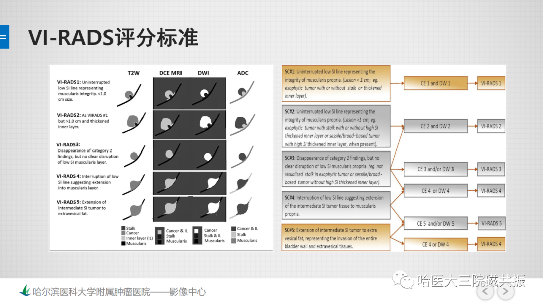 影像PPT - 【PPT】膀胱误诊病例及膀胱癌报告书写规范-20