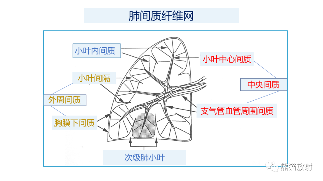 影像PPT - 【PPT】肺炎的常见影像学表现-27
