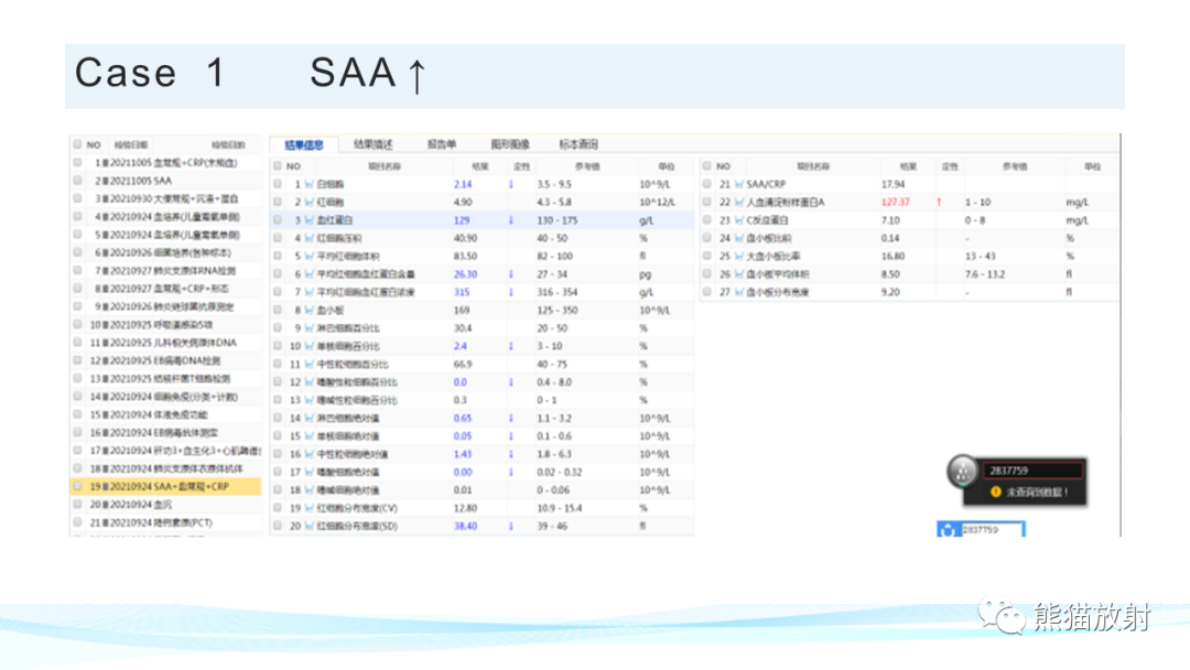 影像PPT - 【PPT】肺炎的常见影像学表现-39