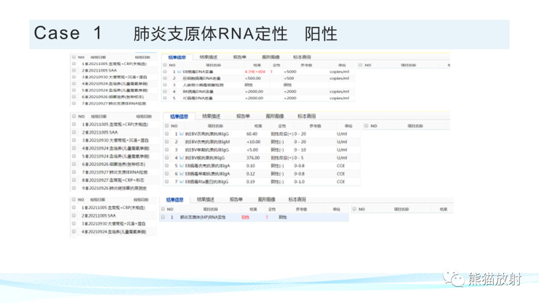 影像PPT - 【PPT】肺炎的常见影像学表现-40