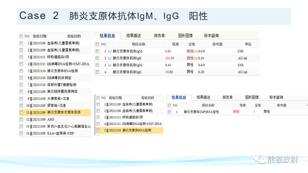 影像PPT - 【PPT】肺炎的常见影像学表现-47
