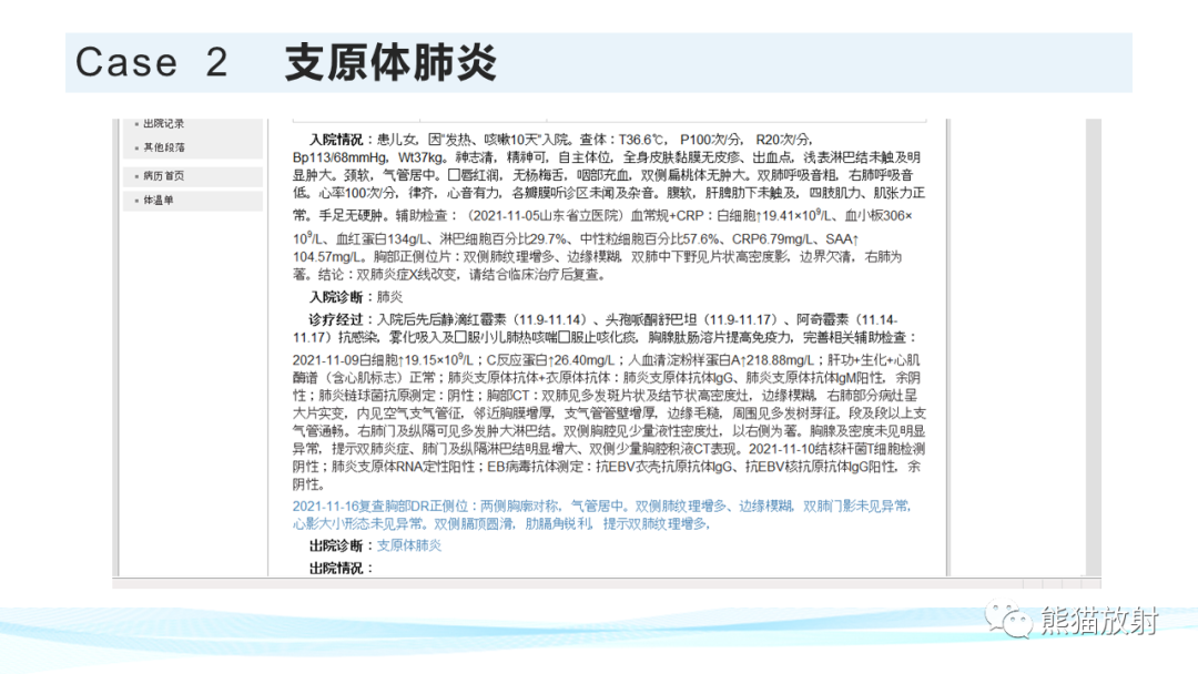 影像PPT - 【PPT】肺炎的常见影像学表现-49