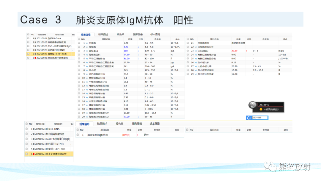 影像PPT - 【PPT】肺炎的常见影像学表现-53