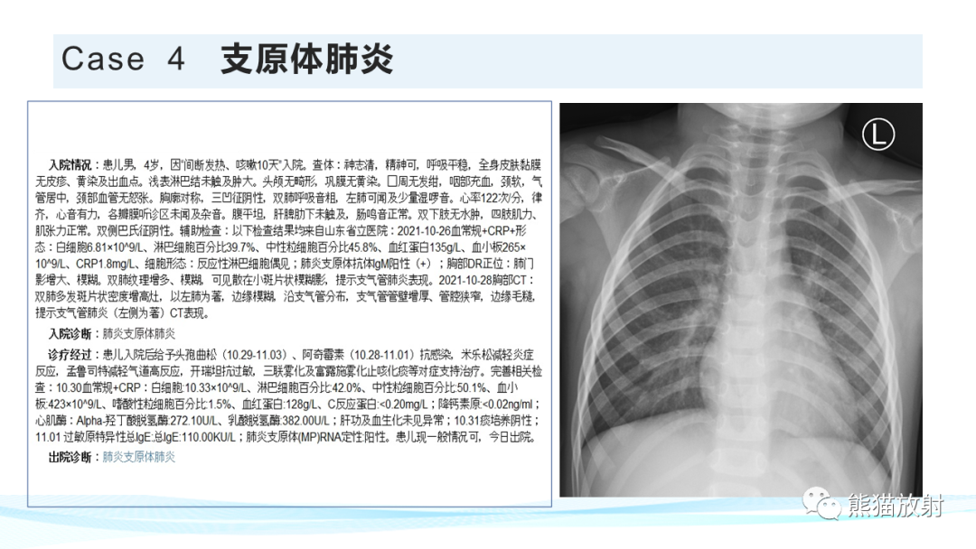 影像PPT - 【PPT】肺炎的常见影像学表现-61