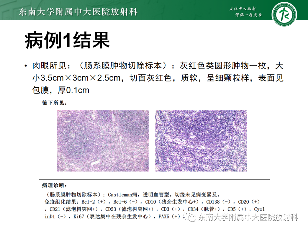 影像PPT - 【PPT】腹部孤立性实性占位病例随访-7 影像PPT - 【PPT】腹部孤立性实性占位病例随访-7