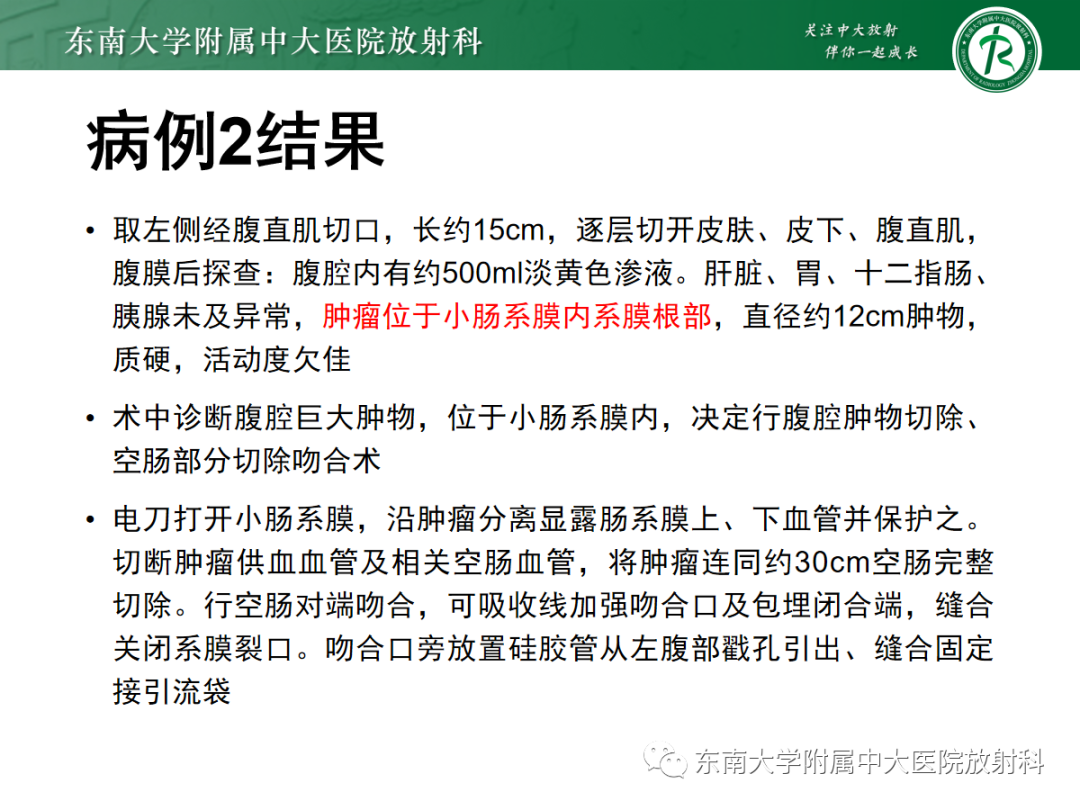影像PPT - 【PPT】腹部孤立性实性占位病例随访-8 影像PPT - 【PPT】腹部孤立性实性占位病例随访-8