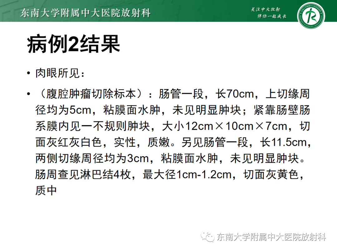 影像PPT - 【PPT】腹部孤立性实性占位病例随访-9 影像PPT - 【PPT】腹部孤立性实性占位病例随访-9