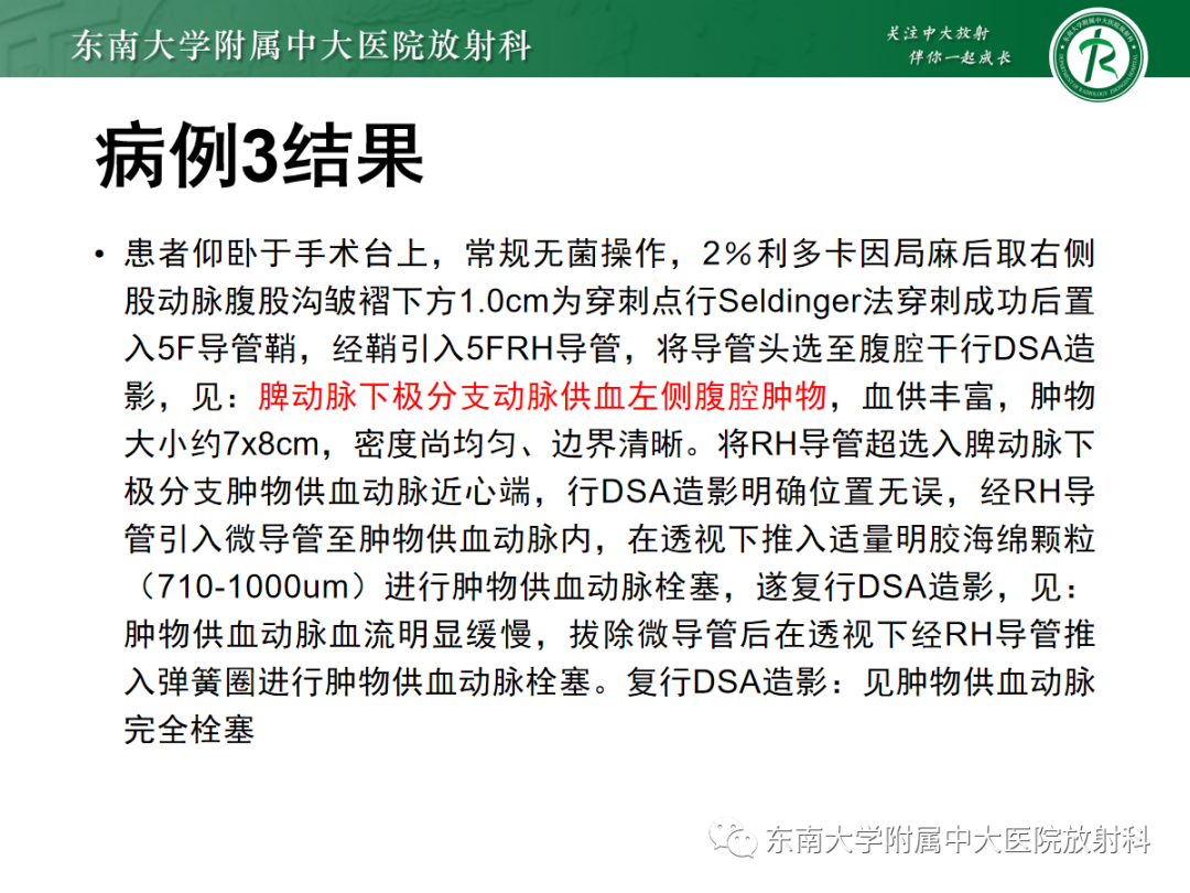 影像PPT - 【PPT】腹部孤立性实性占位病例随访-11 影像PPT - 【PPT】腹部孤立性实性占位病例随访-11