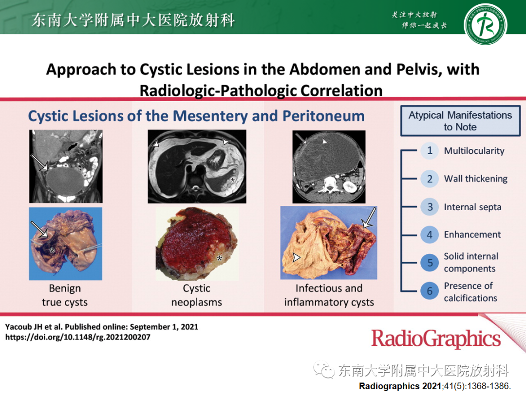 影像PPT - 【PPT】腹部孤立性实性占位病例随访-22 影像PPT - 【PPT】腹部孤立性实性占位病例随访-22