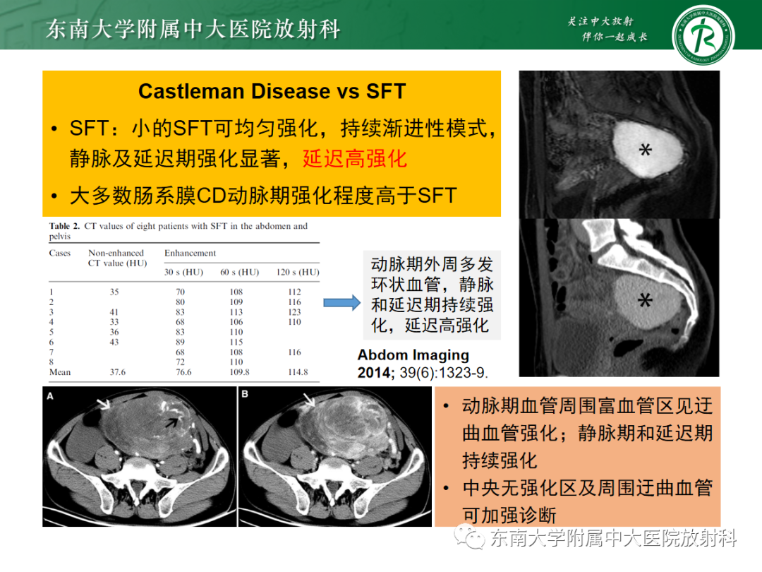 影像PPT - 【PPT】腹部孤立性实性占位病例随访-28 影像PPT - 【PPT】腹部孤立性实性占位病例随访-28