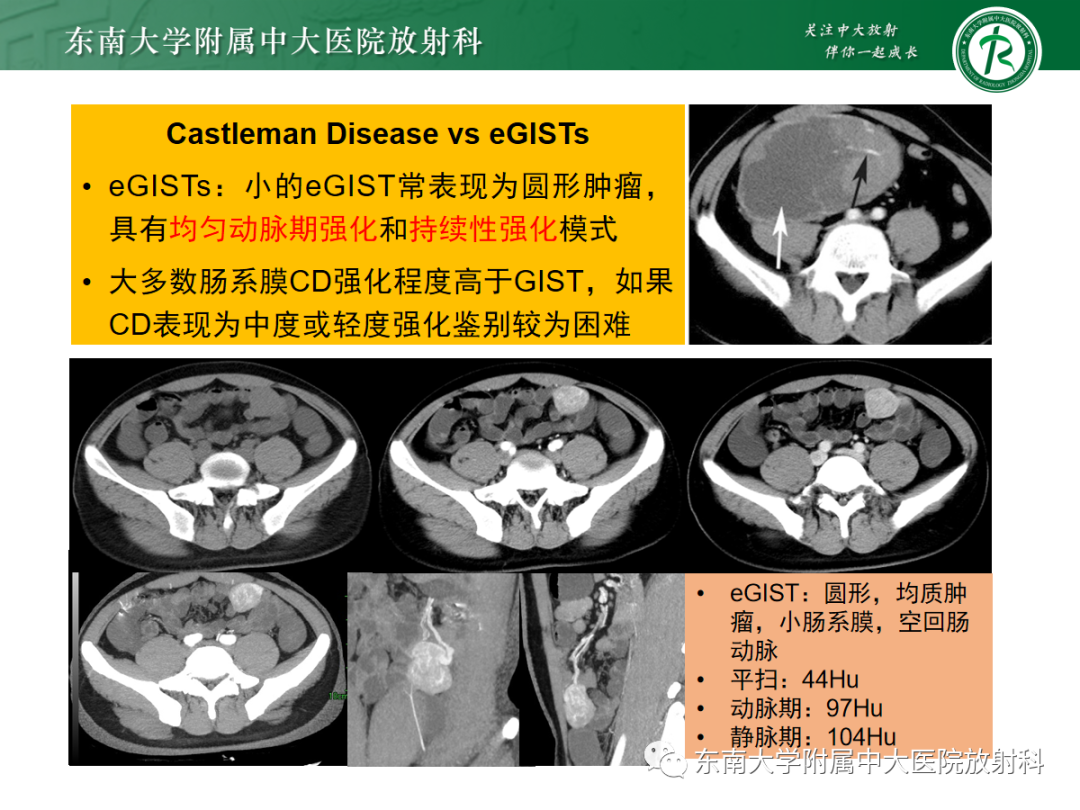 影像PPT - 【PPT】腹部孤立性实性占位病例随访-29 影像PPT - 【PPT】腹部孤立性实性占位病例随访-29