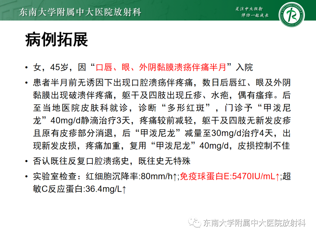 影像PPT - 【PPT】腹部孤立性实性占位病例随访-30 影像PPT - 【PPT】腹部孤立性实性占位病例随访-30