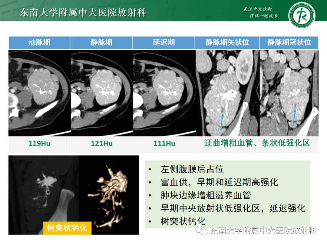 影像PPT - 【PPT】腹部孤立性实性占位病例随访-31 影像PPT - 【PPT】腹部孤立性实性占位病例随访-31