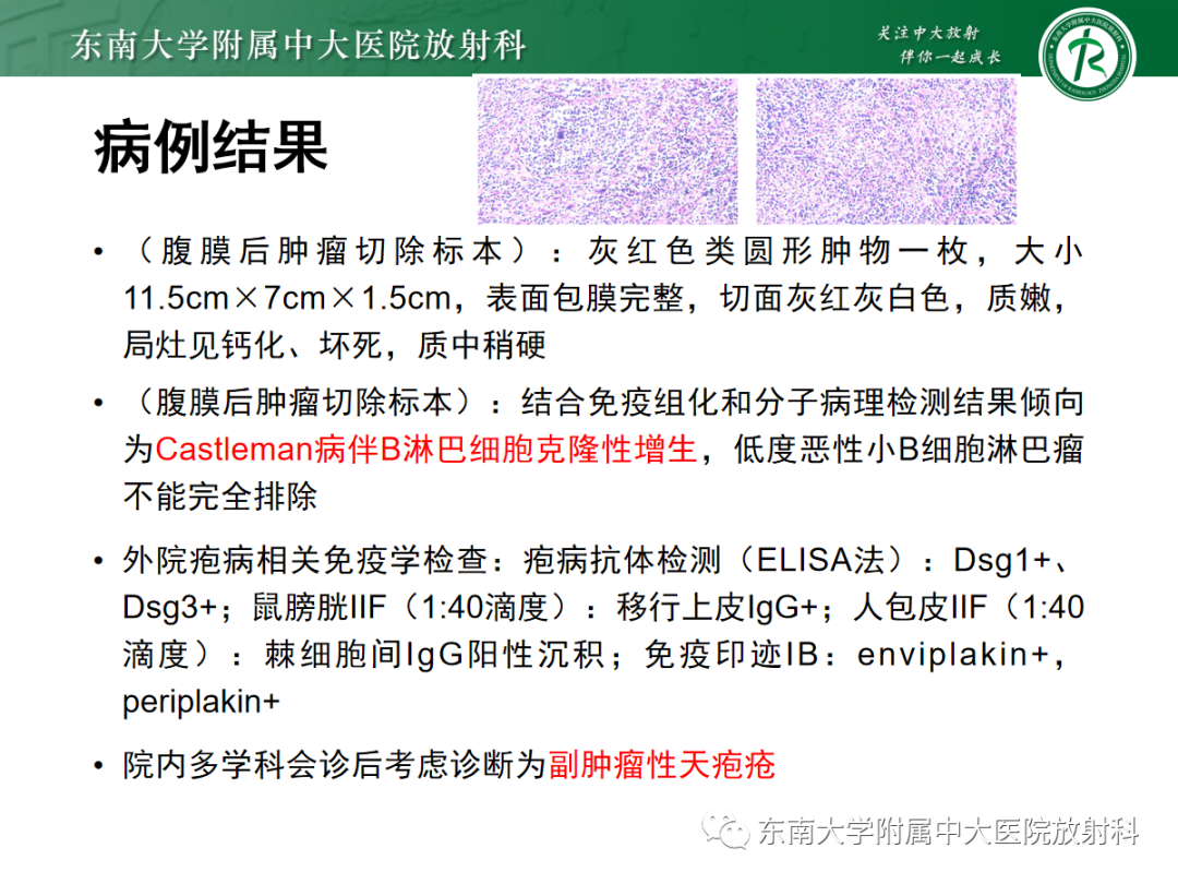 影像PPT - 【PPT】腹部孤立性实性占位病例随访-32 影像PPT - 【PPT】腹部孤立性实性占位病例随访-32