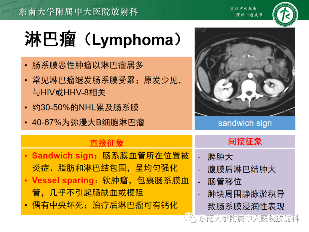 影像PPT - 【PPT】腹部孤立性实性占位病例随访-35 影像PPT - 【PPT】腹部孤立性实性占位病例随访-35