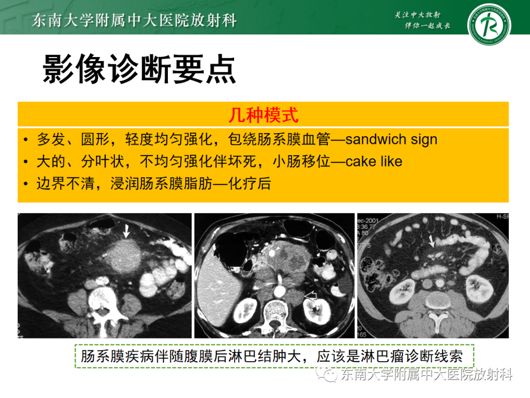影像PPT - 【PPT】腹部孤立性实性占位病例随访-36 影像PPT - 【PPT】腹部孤立性实性占位病例随访-36