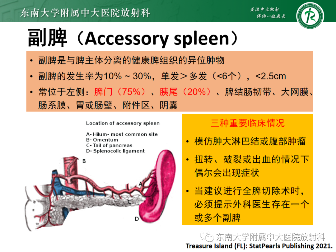 影像PPT - 【PPT】腹部孤立性实性占位病例随访-39 影像PPT - 【PPT】腹部孤立性实性占位病例随访-39