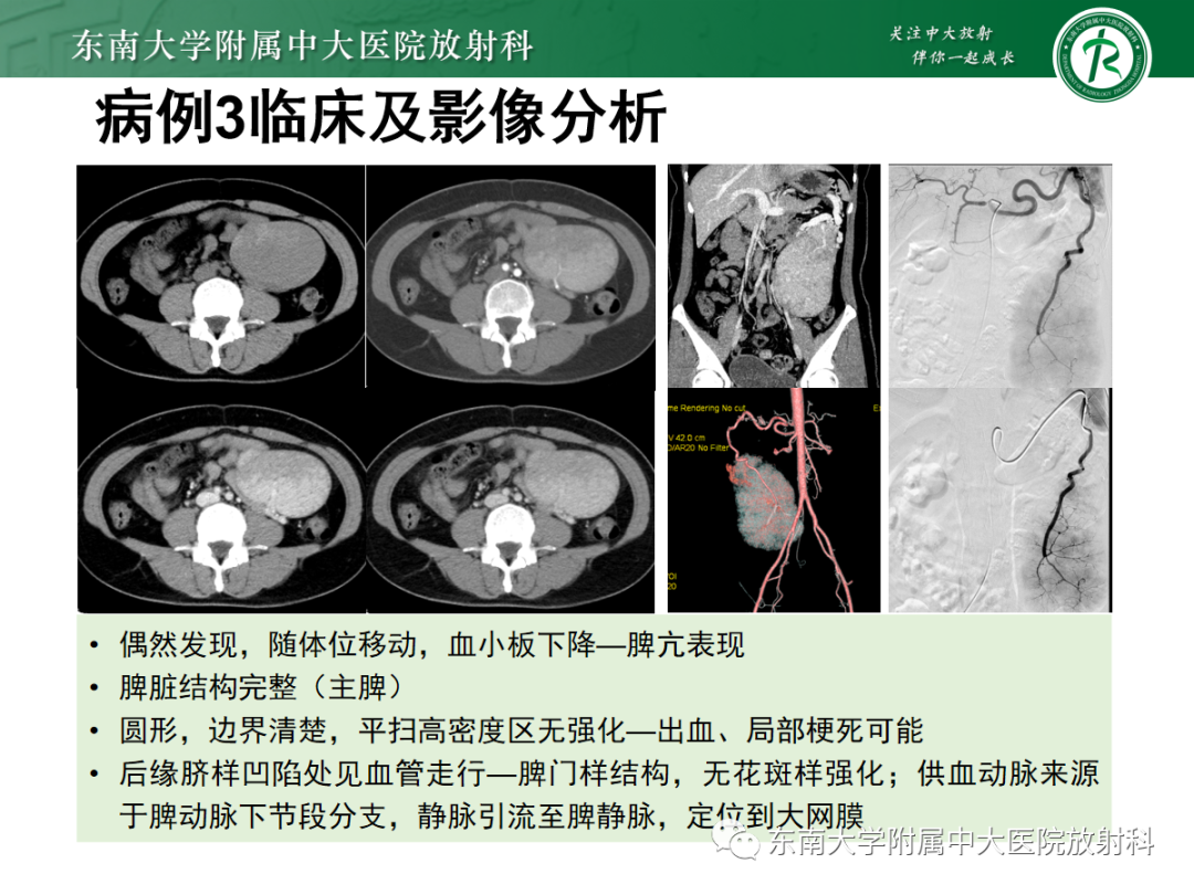 影像PPT - 【PPT】腹部孤立性实性占位病例随访-38 影像PPT - 【PPT】腹部孤立性实性占位病例随访-38