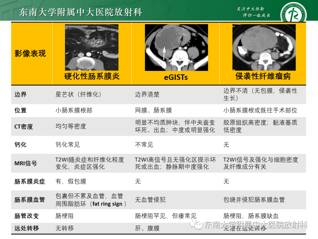 影像PPT - 【PPT】腹部孤立性实性占位病例随访-43 影像PPT - 【PPT】腹部孤立性实性占位病例随访-43