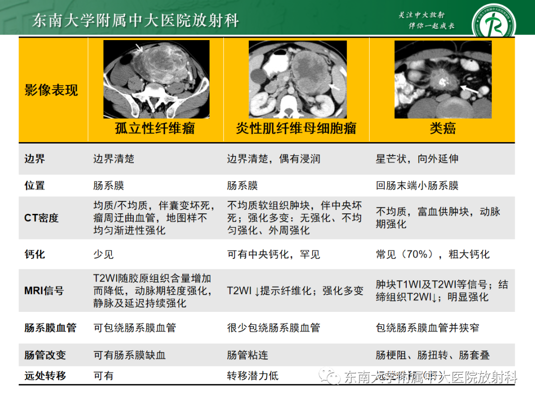 影像PPT - 【PPT】腹部孤立性实性占位病例随访-44 影像PPT - 【PPT】腹部孤立性实性占位病例随访-44