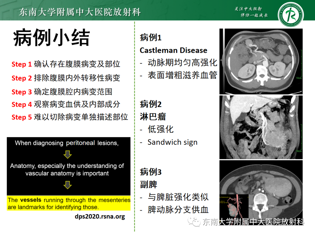 影像PPT - 【PPT】腹部孤立性实性占位病例随访-45 影像PPT - 【PPT】腹部孤立性实性占位病例随访-45