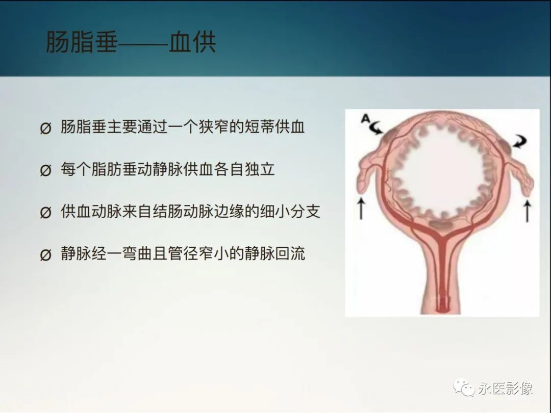 影像PPT - 【PPT】急性原发性肠脂垂炎的CT诊断及鉴别诊断-5