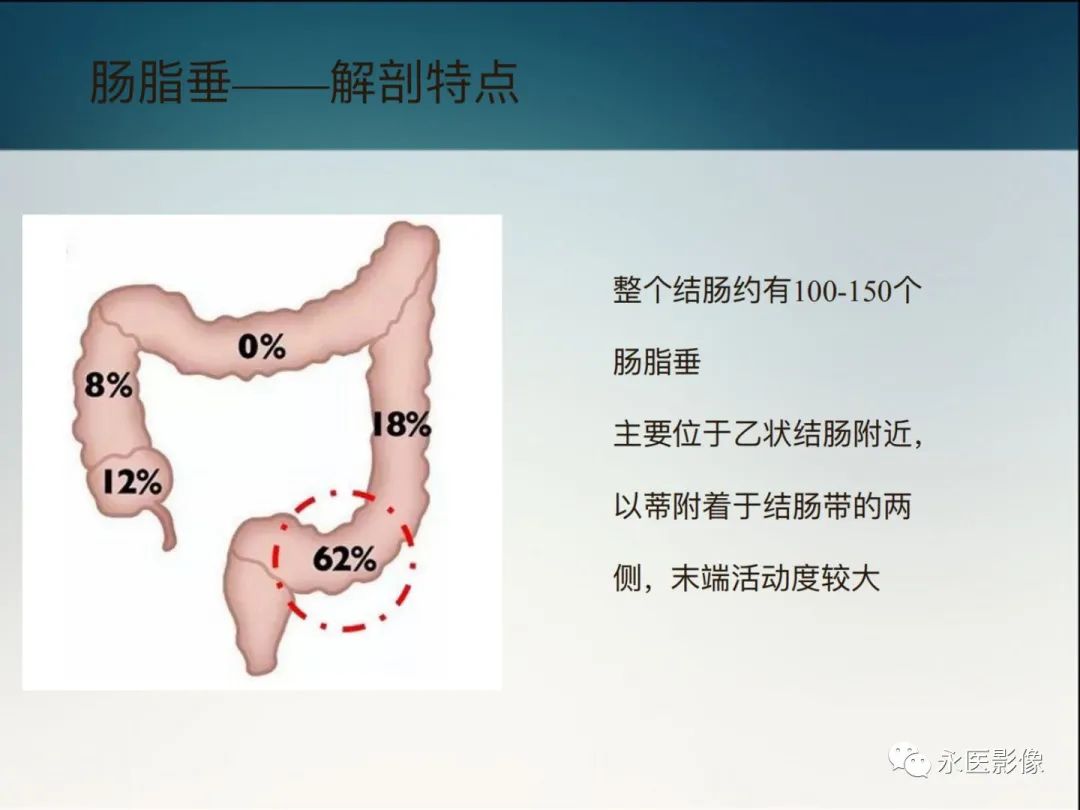 影像PPT - 【PPT】急性原发性肠脂垂炎的CT诊断及鉴别诊断-4