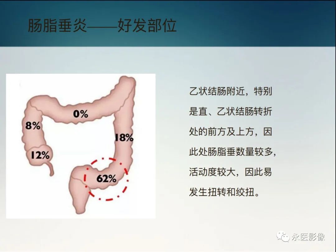 影像PPT - 【PPT】急性原发性肠脂垂炎的CT诊断及鉴别诊断-12