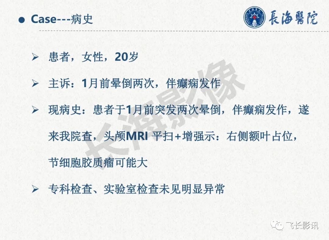 影像PPT - 【PPT】脑节细胞胶质瘤的诊断及鉴别诊断-2