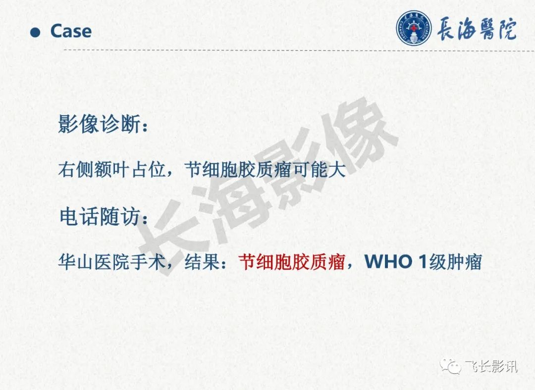 影像PPT - 【PPT】脑节细胞胶质瘤的诊断及鉴别诊断-6