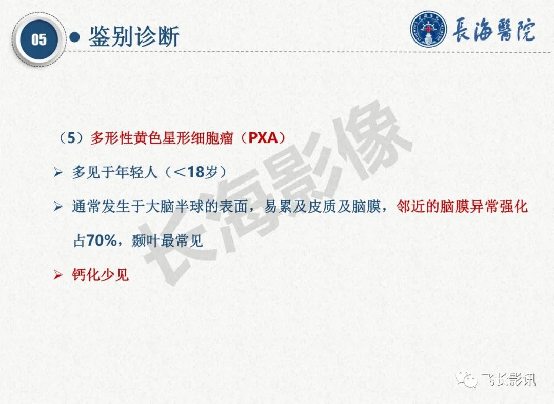影像PPT - 【PPT】脑节细胞胶质瘤的诊断及鉴别诊断-57