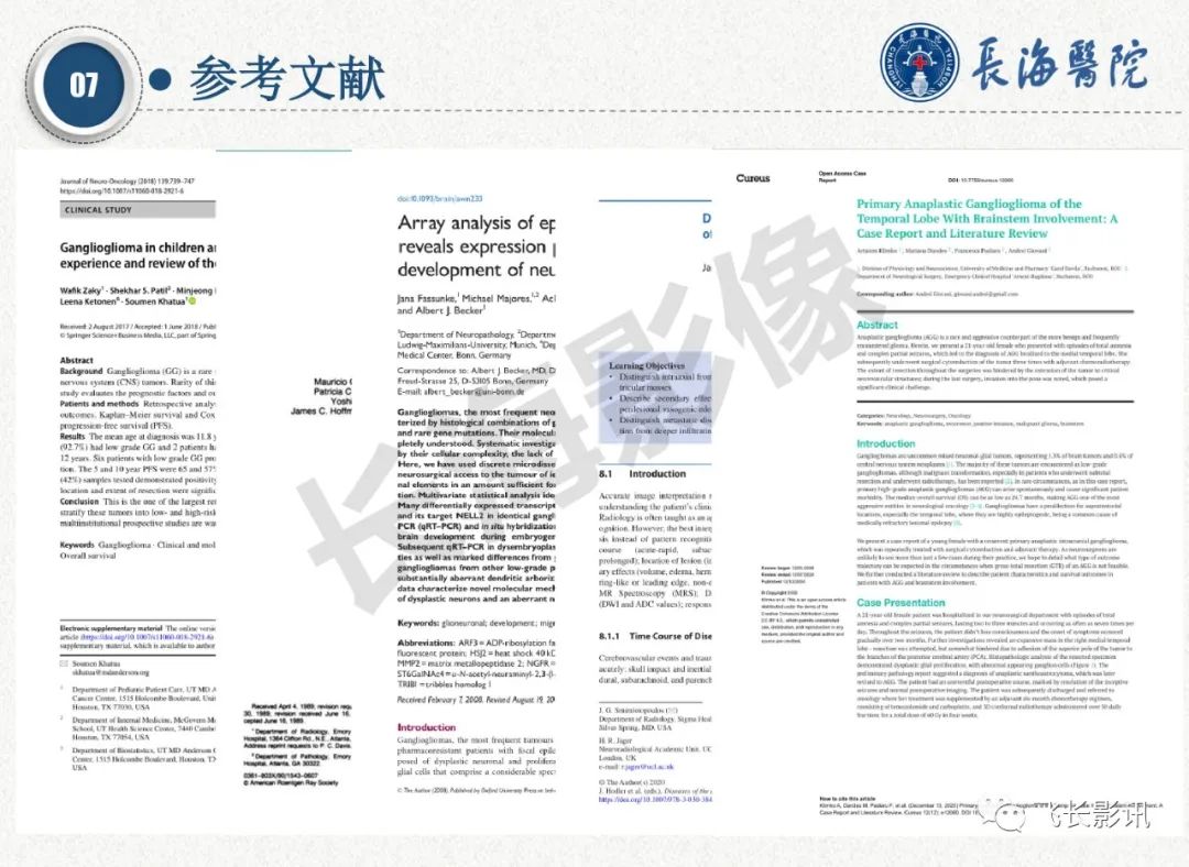 影像PPT - 【PPT】脑节细胞胶质瘤的诊断及鉴别诊断-69