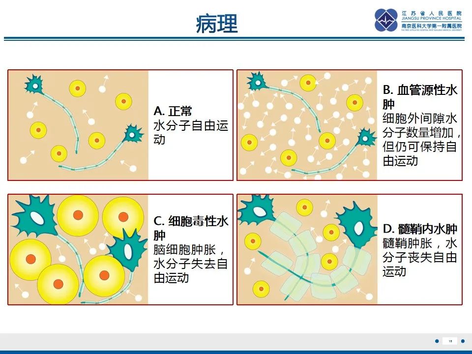 影像PPT - 【PPT】中毒性脑病-16