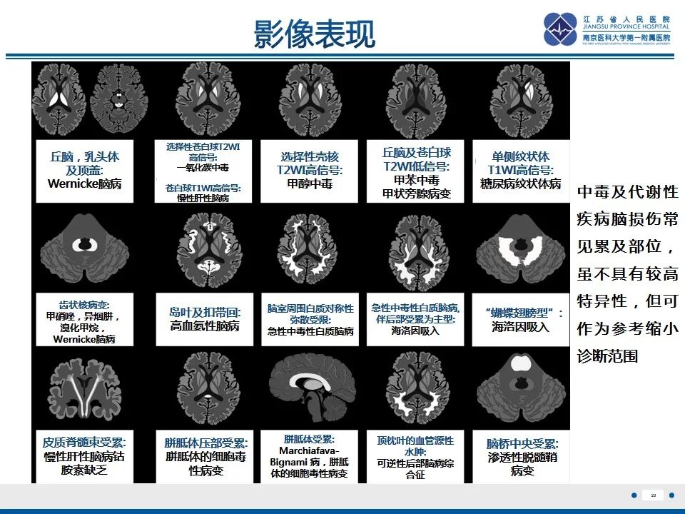 影像PPT - 【PPT】中毒性脑病-30