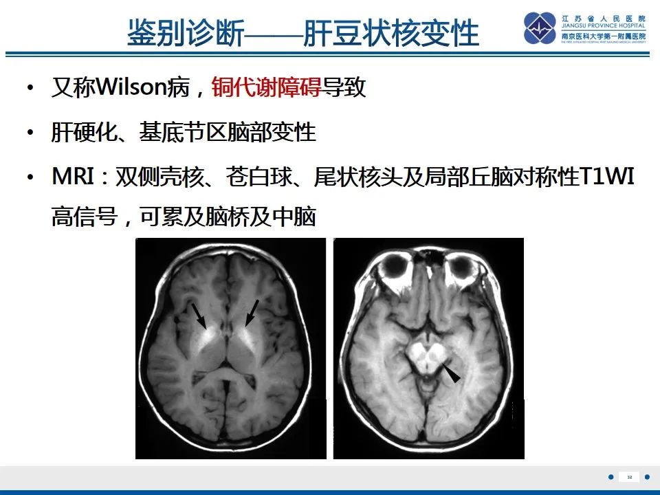 影像PPT - 【PPT】中毒性脑病-33