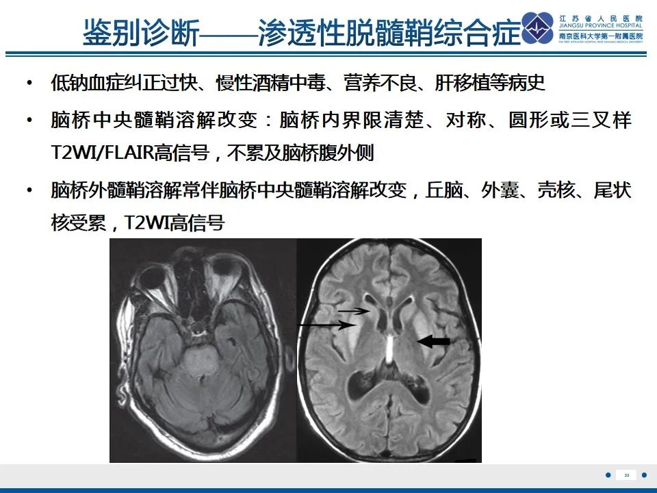 影像PPT - 【PPT】中毒性脑病-34