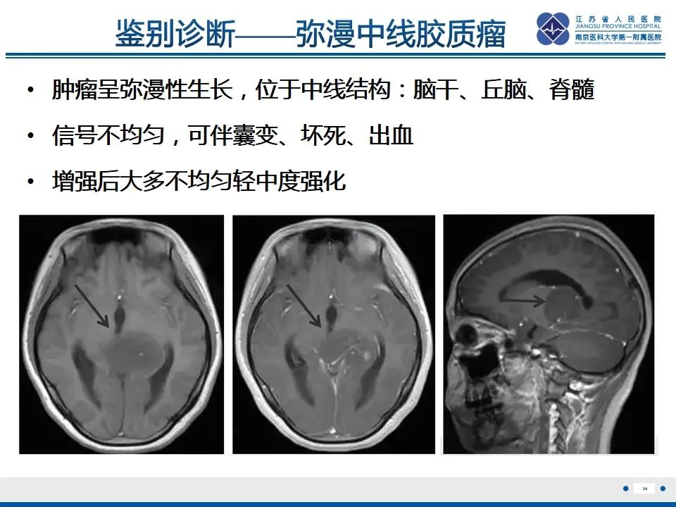 影像PPT - 【PPT】中毒性脑病-35