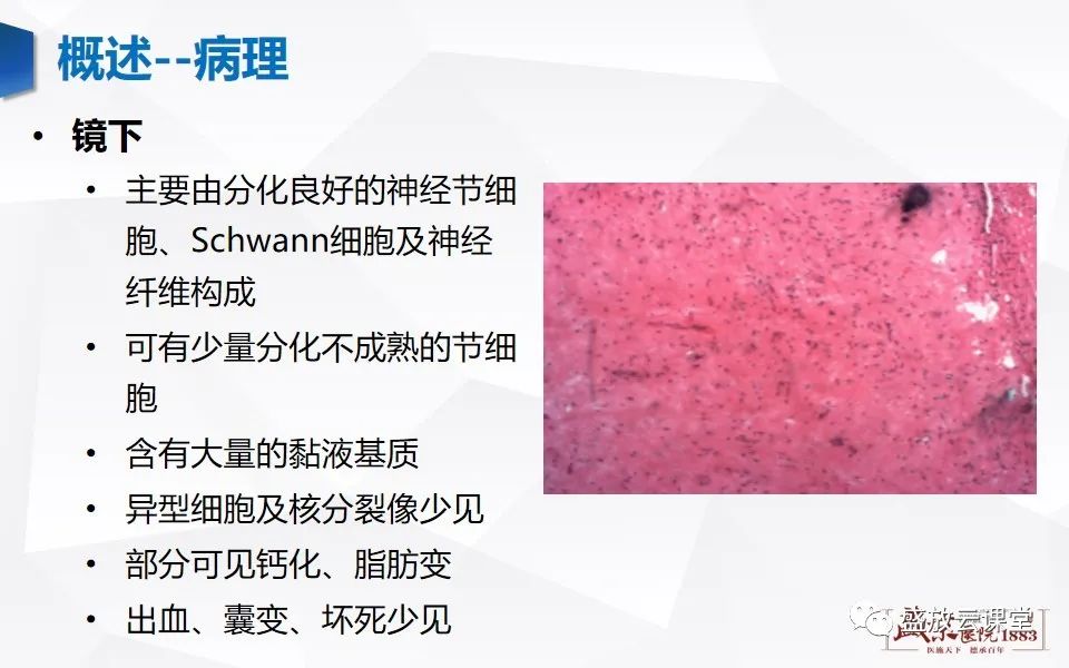 影像PPT - 【PPT】纵隔节细胞神经瘤-5