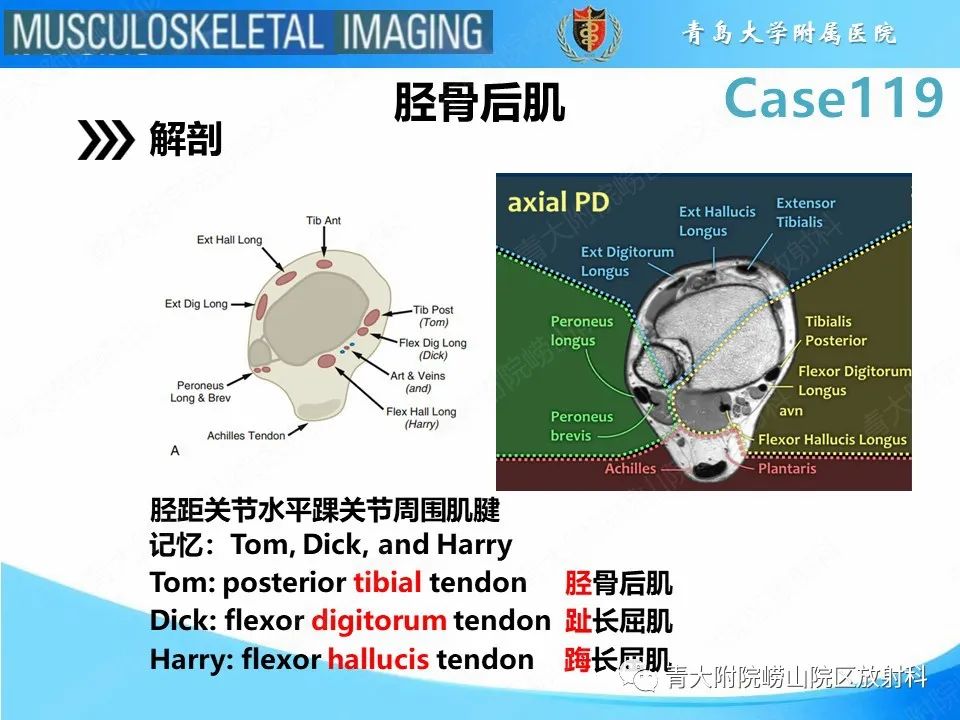 影像PPT - 【PPT】胫骨后肌腱撕裂-12