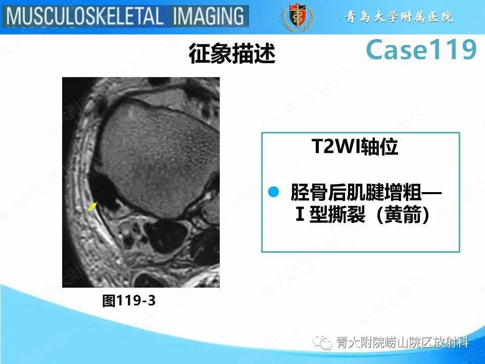 影像PPT - 【PPT】胫骨后肌腱撕裂-23