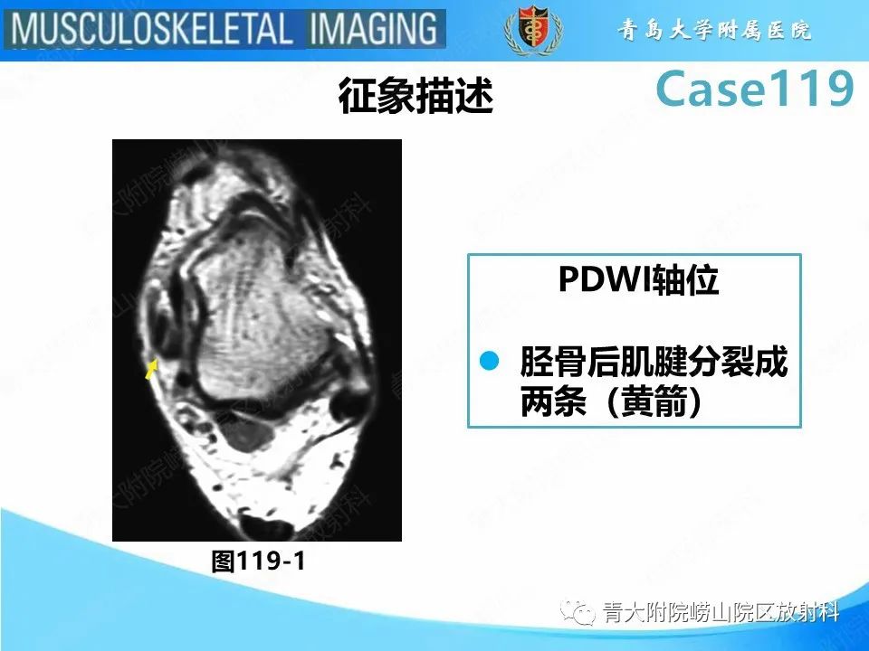 影像PPT - 【PPT】胫骨后肌腱撕裂-21