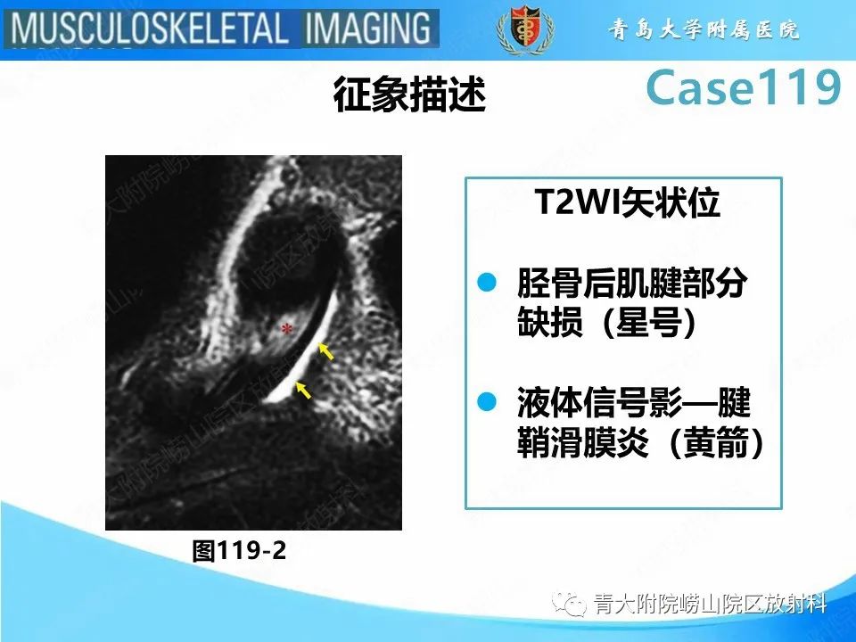 影像PPT - 【PPT】胫骨后肌腱撕裂-22