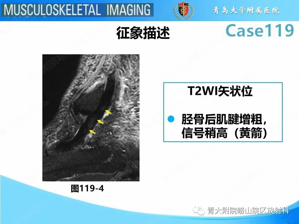 影像PPT - 【PPT】胫骨后肌腱撕裂-24