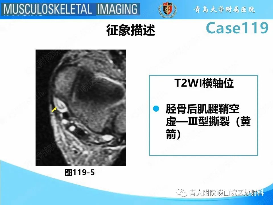 影像PPT - 【PPT】胫骨后肌腱撕裂-25