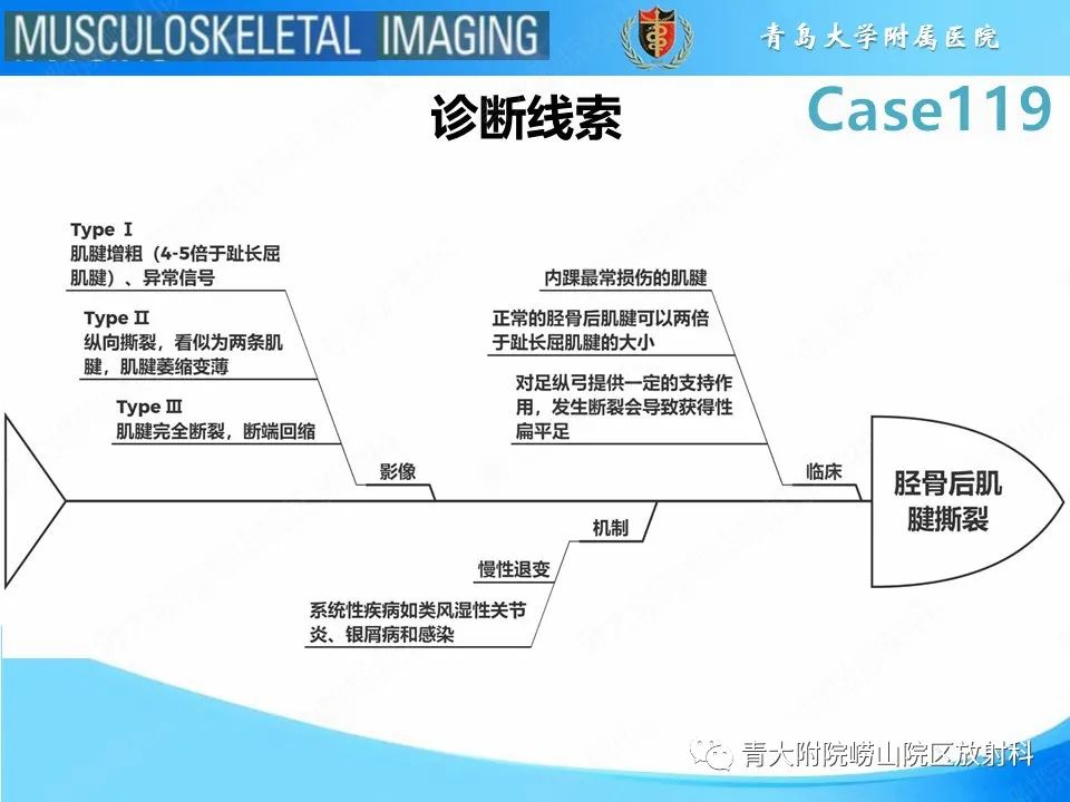 影像PPT - 【PPT】胫骨后肌腱撕裂-27