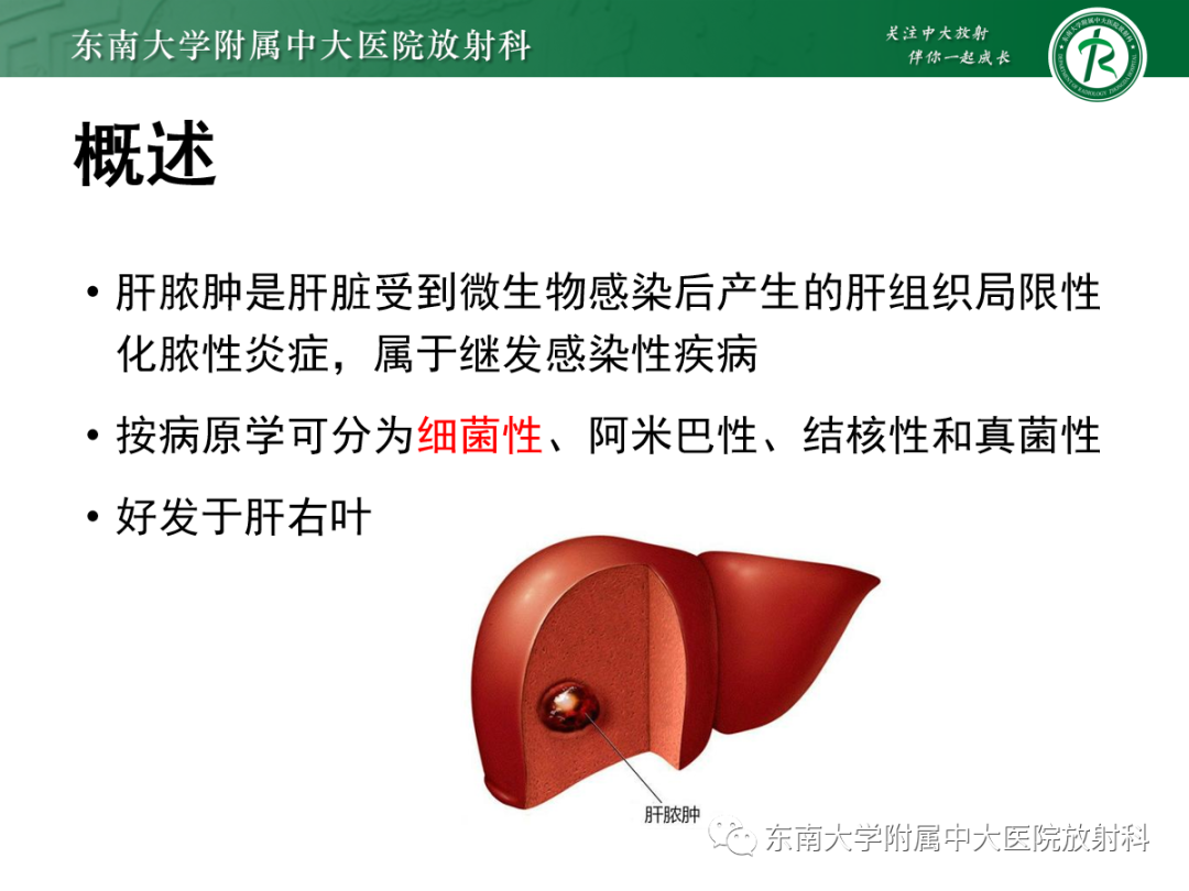 影像PPT - 【PPT】细菌性肝脓肿-3