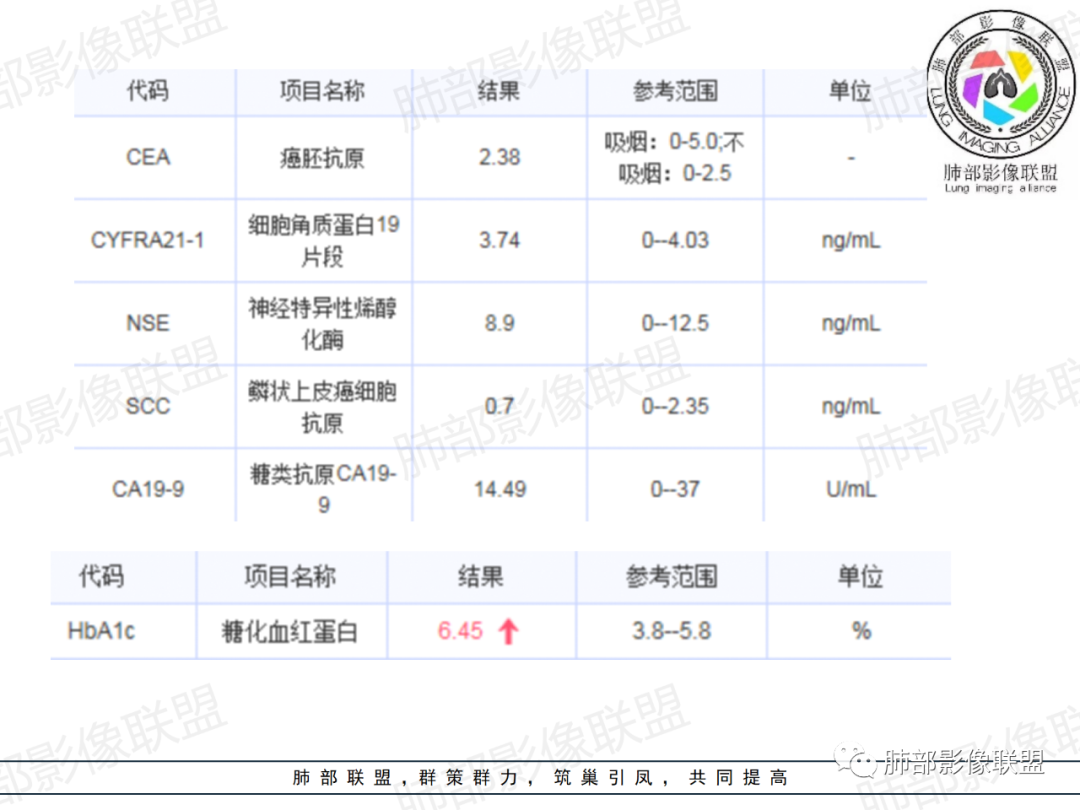 影像PPT - 【病例】从支气管影像改变区分肿瘤与结核-4 影像PPT - 【病例】从支气管影像改变区分肿瘤与结核-4