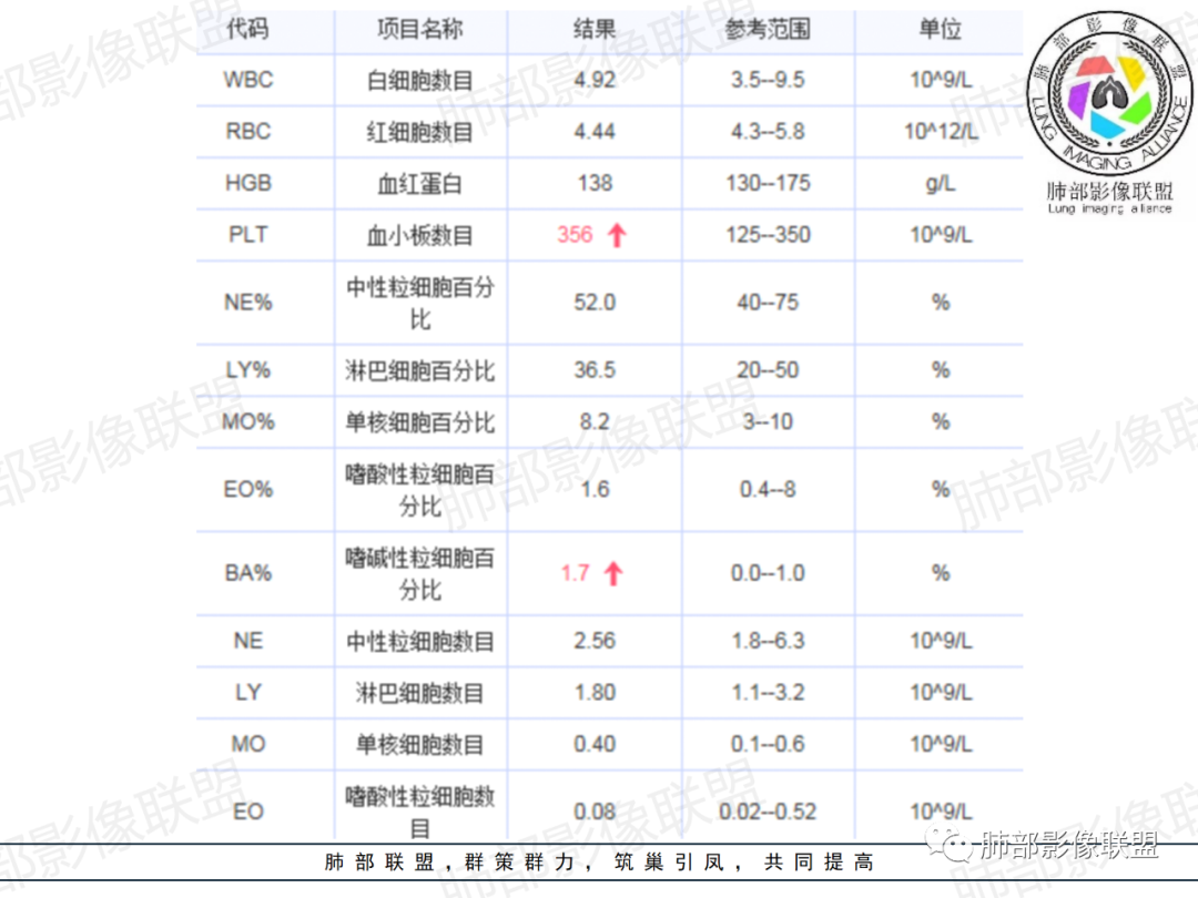 影像PPT - 【病例】从支气管影像改变区分肿瘤与结核-5 影像PPT - 【病例】从支气管影像改变区分肿瘤与结核-5
