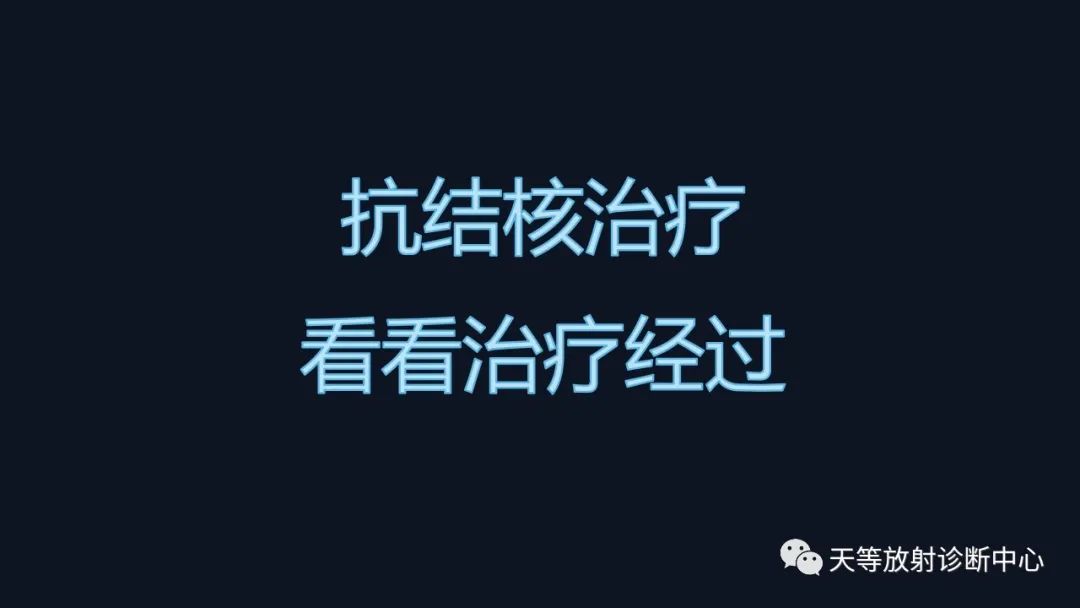 影像PPT - 【病例】肺结核1例CT影像-16 影像PPT - 【病例】肺结核1例CT影像-16